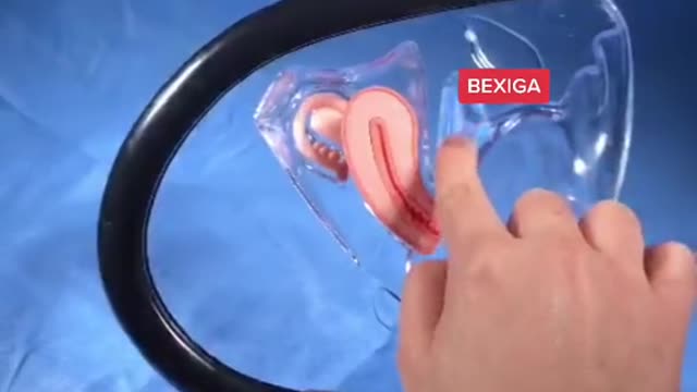 Você já viu como se coloca uma sonda
