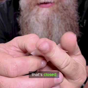 Stitch those wounds!