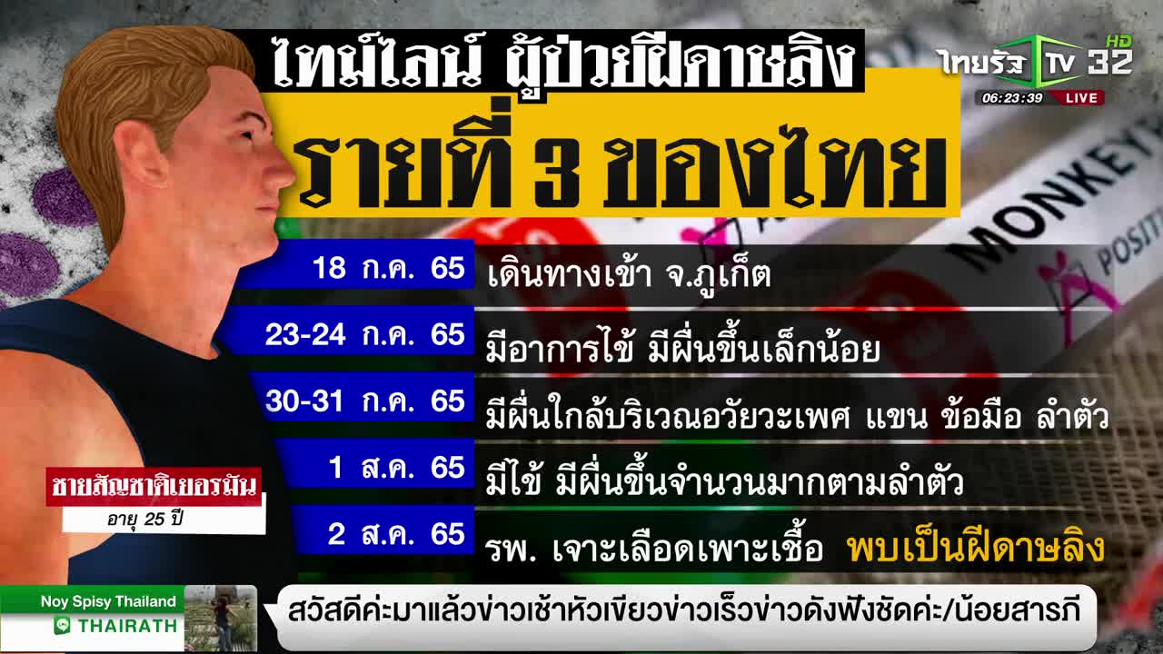 พบชาวเยอรมันป่วย #ฝีดาษลิงรายที่ 3 ของไทย | 04-08-65 | ห้องข่าวหัวเขียว