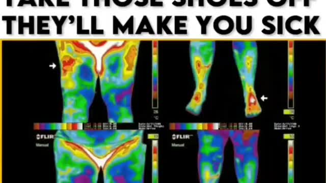 Shoes are Toxic. Ground at least 15 mins per day (when the weather permits).