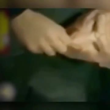 얼굴이 너무 간지러운 교황