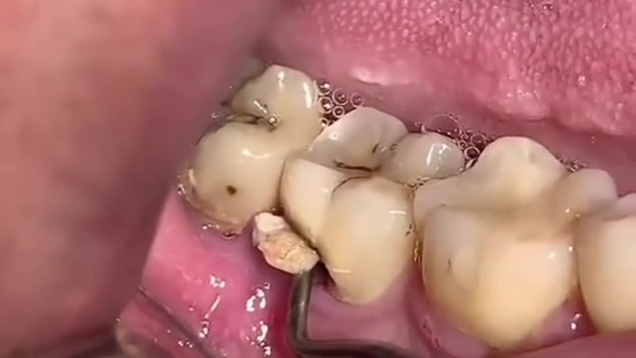 dental treatment