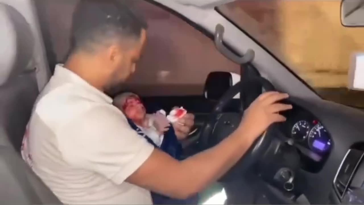 Little Angle of Palestine get injured but heavy US Bomb