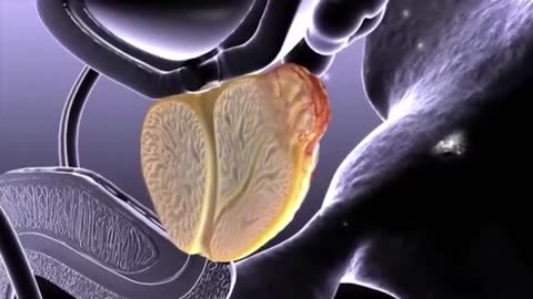 Top Prostate Breakthrough - Health Tips