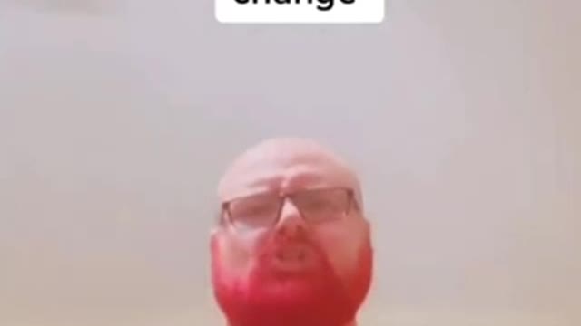 Retard of TikTok