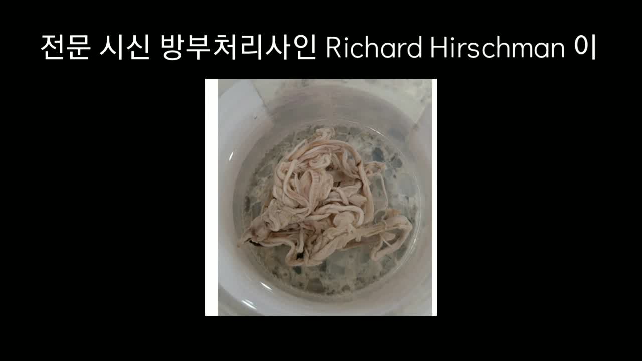 혈전사고 3(뇌+)