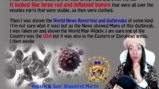 Prophetic Warning Vision: 10-27-24 Outbreak in 2or More Countries