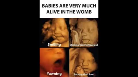 Human Baby Parts Trade is REAL!