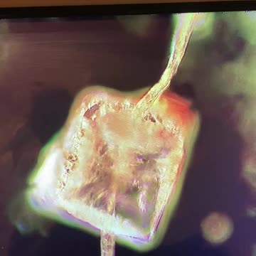 Biosensor Technology with Antennae in Human Blood For Receiving and Transmitting Bio Data to the Internet of Nano Things (IoNT)