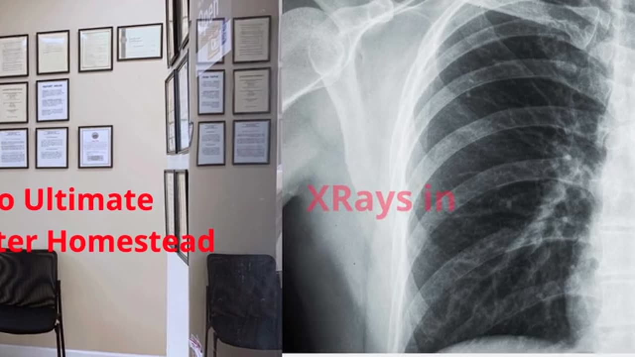 Ultimate Diagnostic Center : Best XRays in Homestead | (305) 393-8102