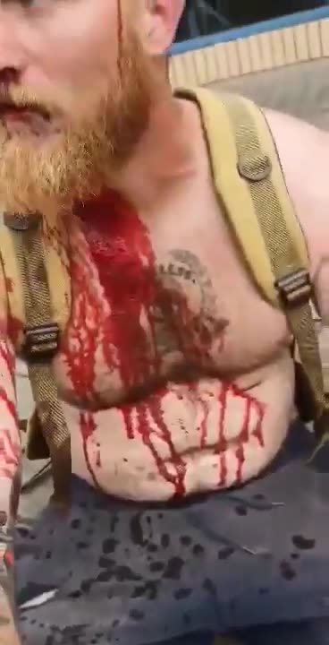 Two British men stabbed and attacked with hammers in Stoke by gangs of Muslims