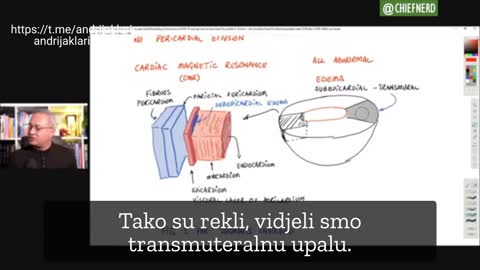 Miokarditisi i perikarditisi kod djece