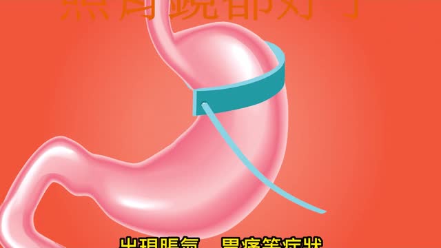 胃結石喝可樂 照胃鏡都好了
