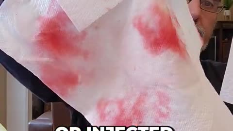 how to spot a chemically injected watermelon