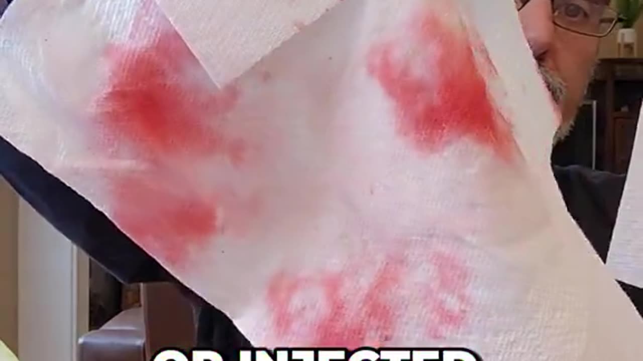 how to spot a chemically injected watermelon