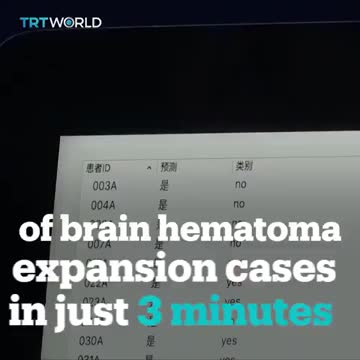 AI Take Over A Room Full of Doctors1