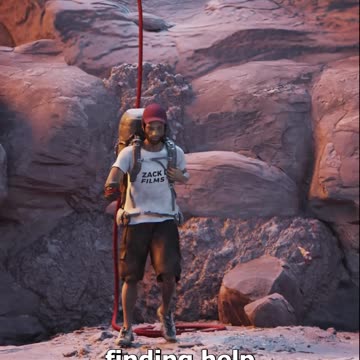 The Man Who Cut Off His Own Arm 😨