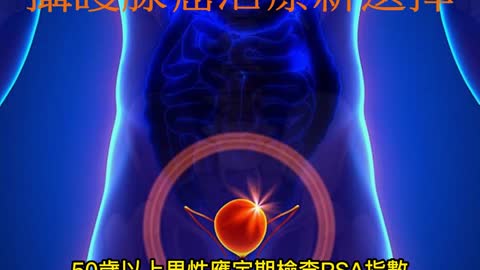 抗荷爾蒙口服藥 攝護腺癌治療新選擇