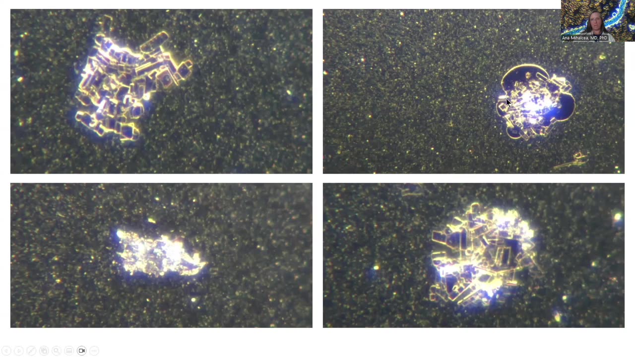 EDTA + Vitamin C - The COVID19 Nanotechnology Bioweapon Antidote – Microscopy Analysis - Truth