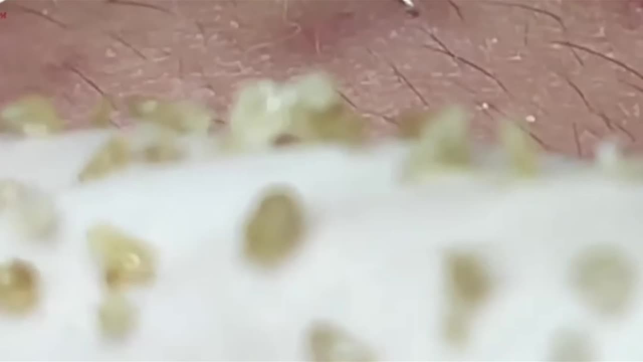 Satisfying Whiteheads extaction!