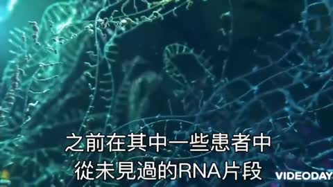 cov19系列-武漢肺炎存在 01 (外泌體理論exosome theory)vs(病毒理論virus theory)