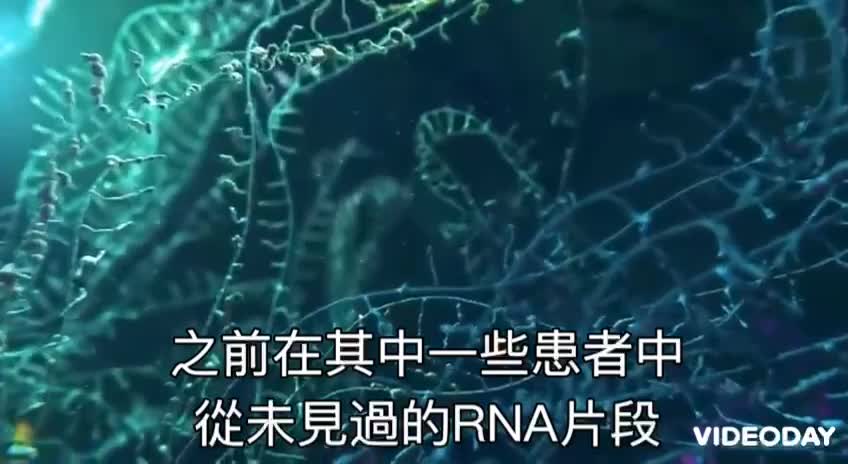 cov19系列-武漢肺炎存在 01 (外泌體理論exosome theory)vs(病毒理論virus theory)