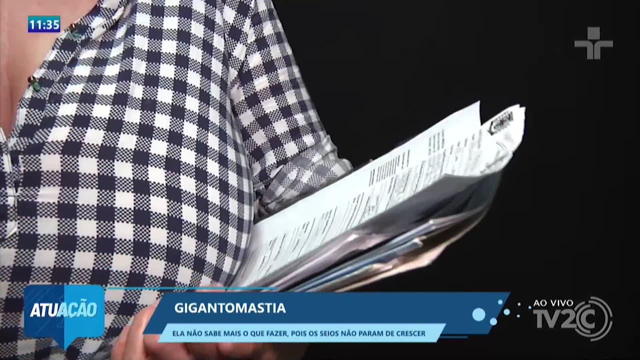 Gigantomastia — Ela não sabe mais o que fazer, pois os seios não param de crescer