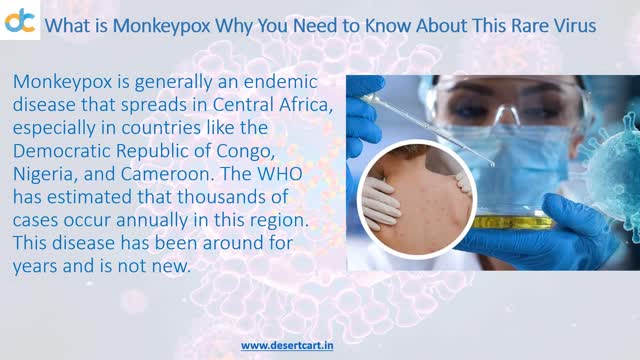 What is Monkeypox Why You Need to Know About This Rare Virus