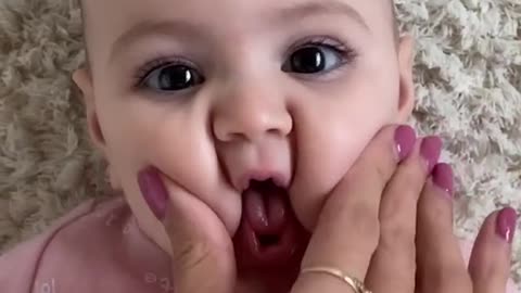 Cute Baby Cheek Remix