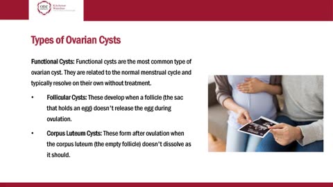 All About Ovarian Cysts and Fertility