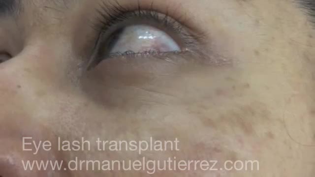 Receive effective hair loss solution from us