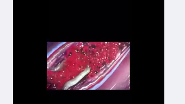 What is the MRNA Vaccine