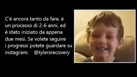 Autistico dopo i vaccini, guarito disintossicandosi dai metalli