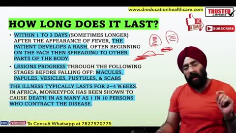 Monkeypox Virus : Symptoms, Transmission, Vaccine & Treatment | Complete Information