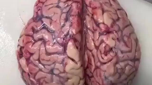 Double v4Xx3d brain autopsy