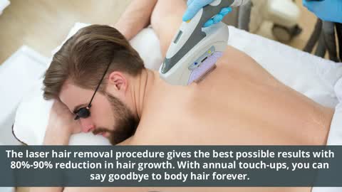 Reasons Men Should Get Laser Hair Removal