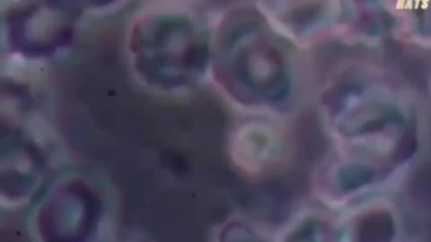 analysis of an unvaccinated person and vaccinated person’s blood under a microscope.