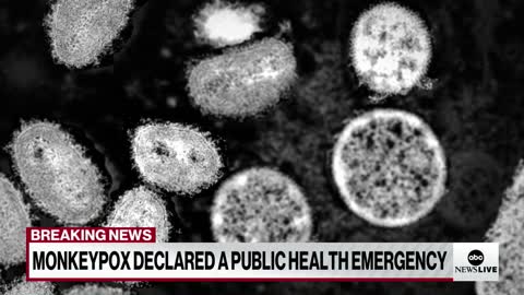 Gli USA dichiarano l'epidemia di vaiolo delle scimmie un'emergenza sanitaria pubblica.Gli USA guidano il mondo nei casi noti di vaiolo delle scimmie,secondo i Centers for Disease Control and Prevention.