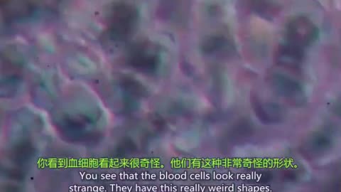 有苗 無苗 血液不同