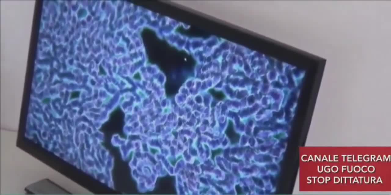 Analisi sangue sierati