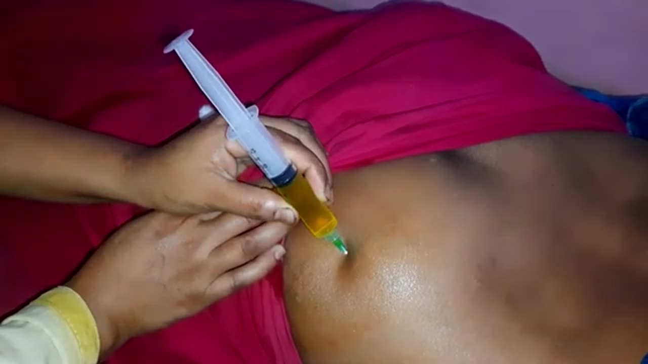 Painful intramuscular injection