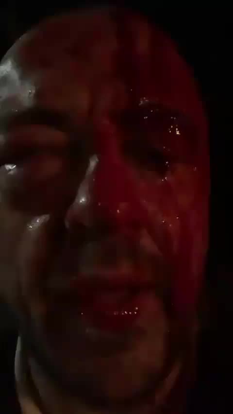 Prominent Italian Gabriele Rubini Attacked by Jews at Home