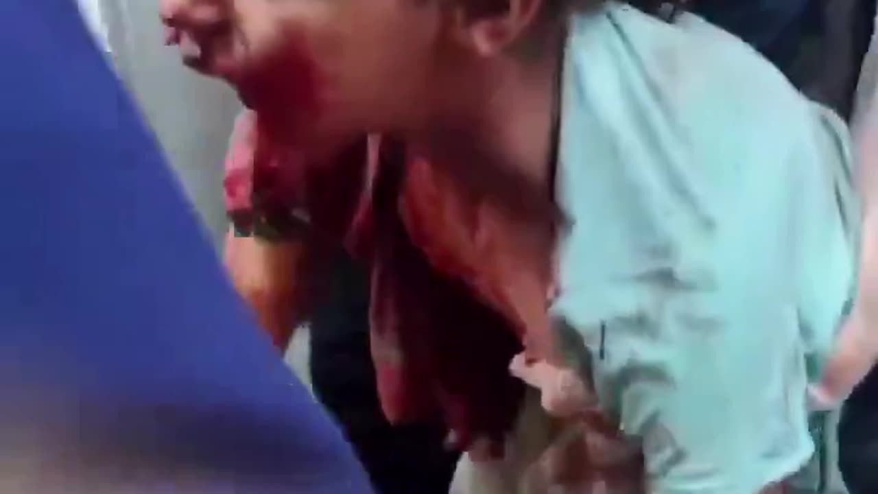 SUPPORTED AND PAID BY THE ROTTEN WEST!!!!! What the hell is israel doing to children?!!!