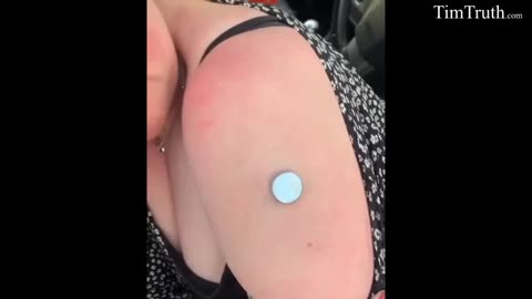 Perché le calamite si attaccano sul punto dell'iniezione da vaccino??