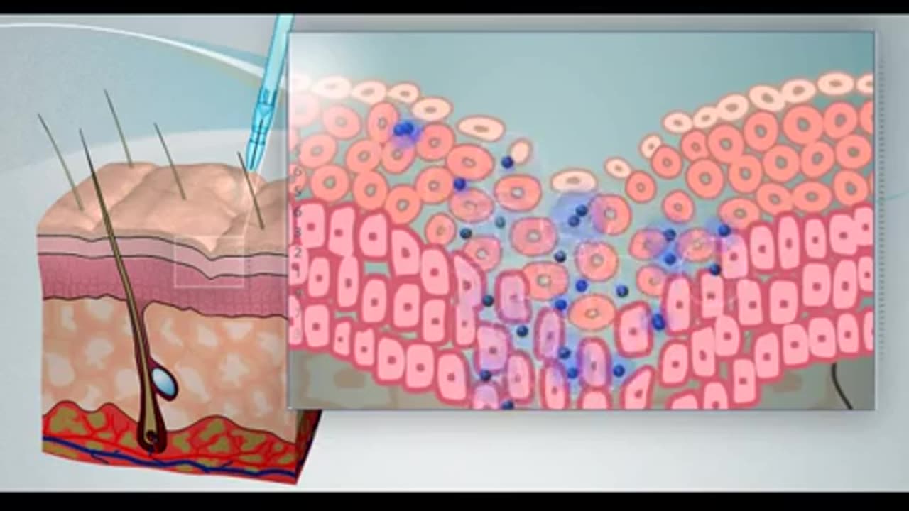 Best Non Invasive Facial Treatments for Youthful Skin