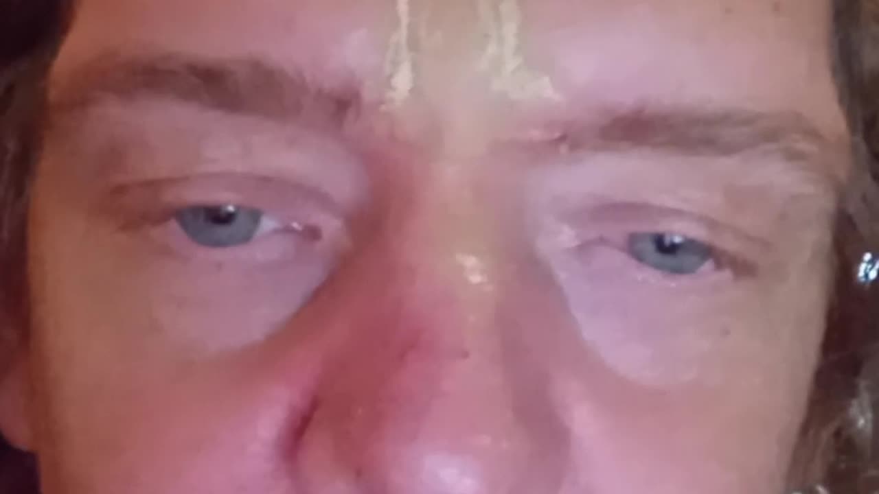 Kristo Gabriel :Surviving the attacks.