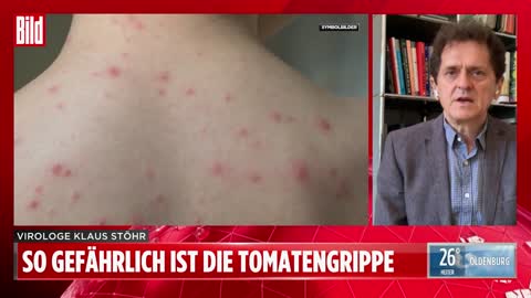 Tomaticus, Hermiticus - potenziell tödlich!