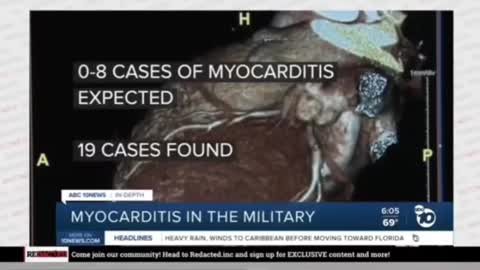 ⚫1672. VACCINE💉Holocaust. U S. Military