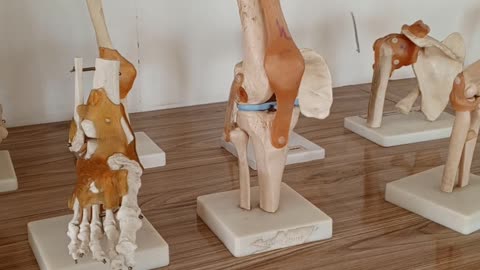 Bones