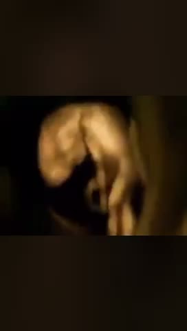3D ultrasound of baby in womb